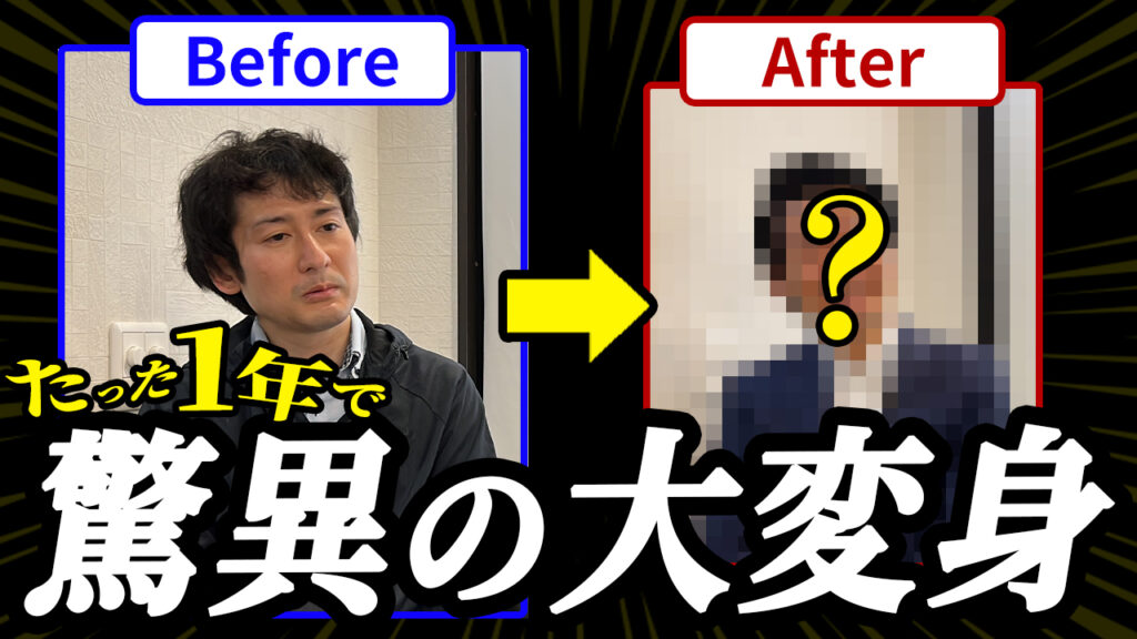 【若返り】30代後半のメンズが植毛して1年経過したらイケオジに大変身！？