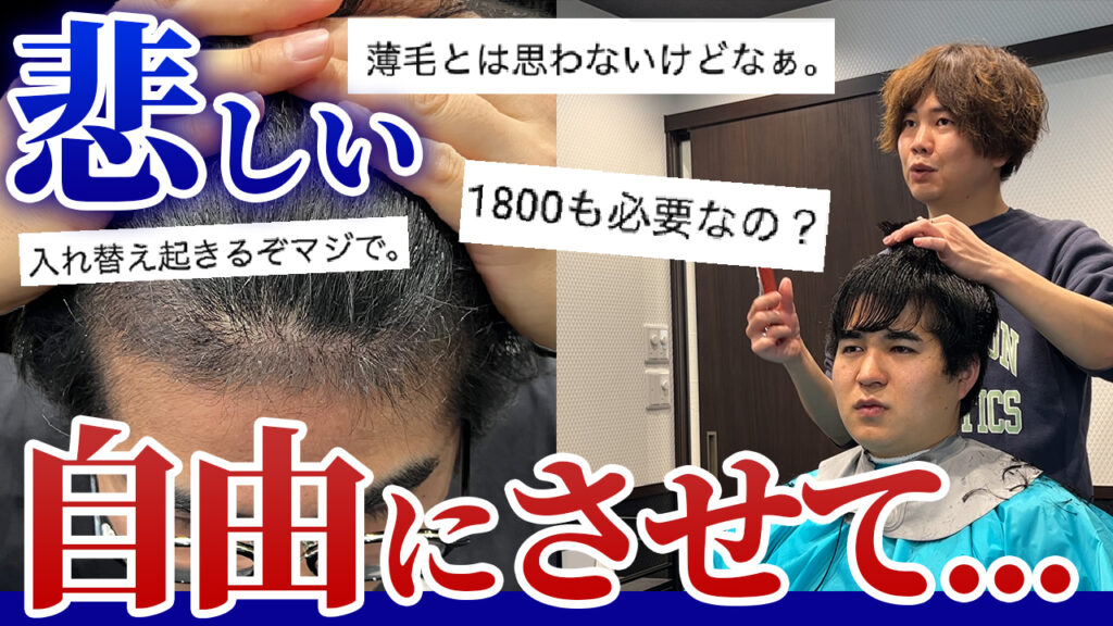 【植毛3ヶ月経過】30代の薄毛男性が厳しい意見に不満が爆発!?