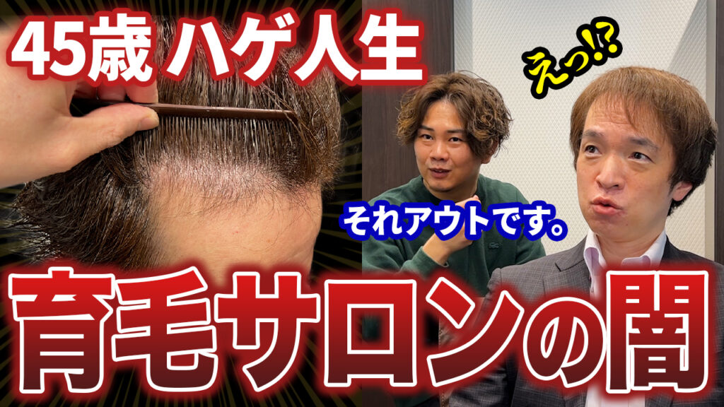 【初登場】20年以上薄毛に悩み続けた40代メンズが植毛に挑戦!!育毛サロンのとんでもない闇を知った...。